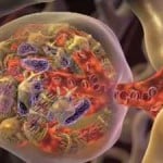 Stem-Cell-Therapy-Diabetic-Nephropathy Stem-Cell-Therapy-Diabetic-Nephropathy