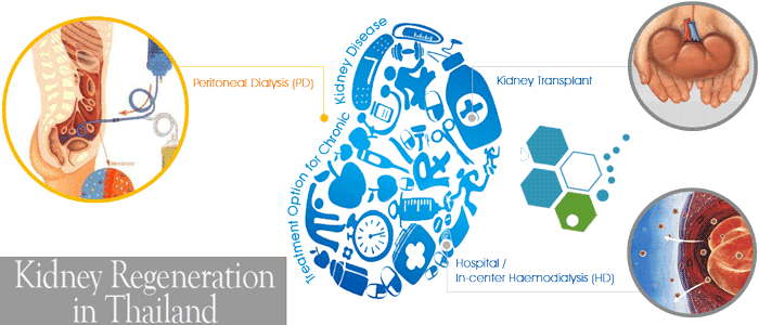 Kidney-disease-therapy-in-bangkok-thailand