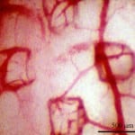 Stem-Cell-angiogenesis-Erectile-Dysfunction Stem-Cell-angiogenesis-Erectile-Dysfunction