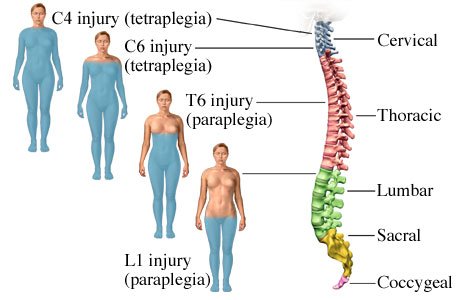 Stem-cell-treatment-of-Spinal-Cord-Injury Stem-cell-treatment-of-Spinal-Cord-Injury