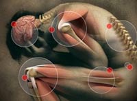fibromyalgia-stem-cell-therapy-thailand