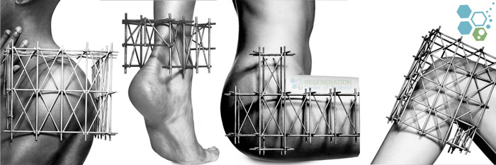 treat sports injuries stem cellstreat sports injuries stem cells