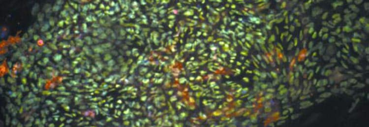 amniotic membrane cell
