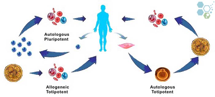 aulogous stem cells