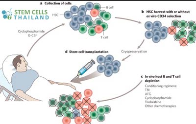 autologous-stem-cells-therapy