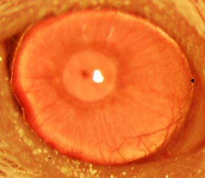regrown-cornea-stemcells