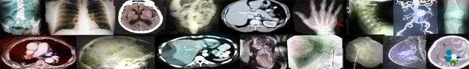 stem cells thai regen head