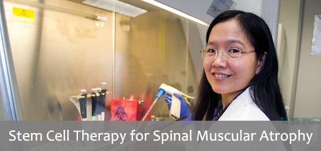 SMA Spinal muscular atrophy stem cell transplant
