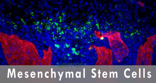 mesenchymal stem cells