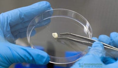 dental-stem-cells