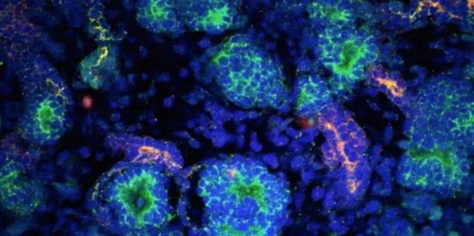 stemcells