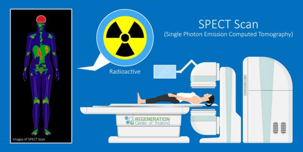 cancer treatment in thailand