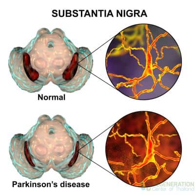 substantia-nigra-stemcells