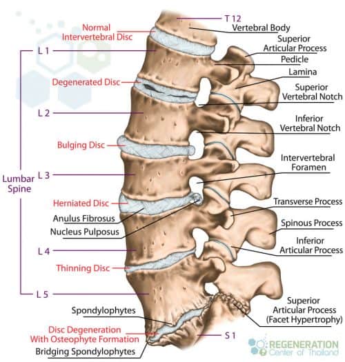 spinal-degeneration-intervertebral-discs
