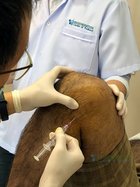 stemcells for MCL knee injury