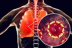 corona-heart-disease