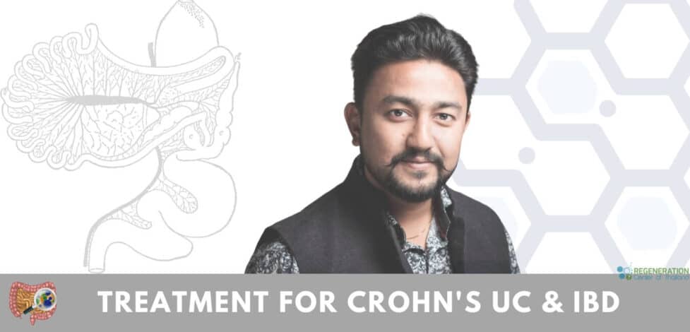 stemcells treatment Crohns ibd uc autoimmune