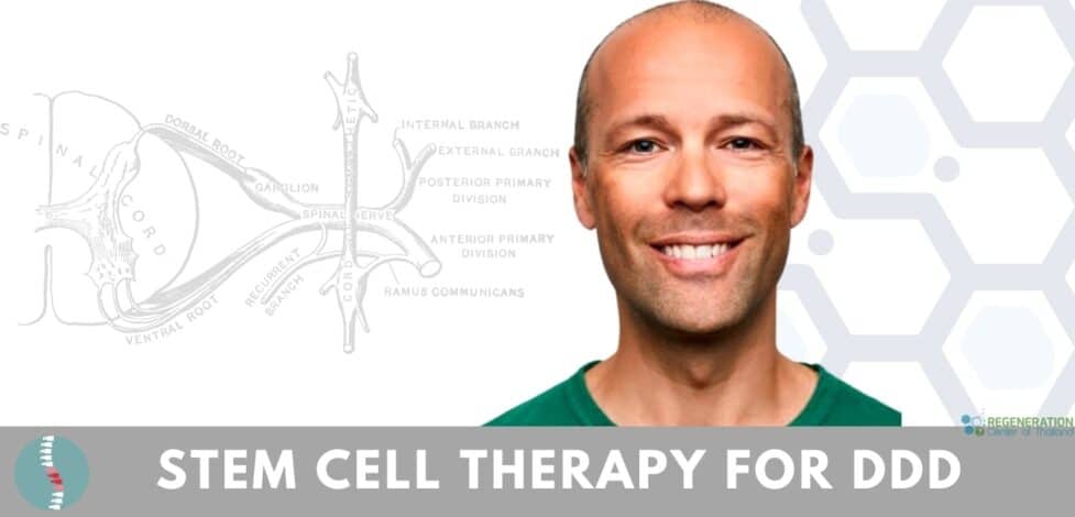 stemcells degenerative disc disease ddd back pain