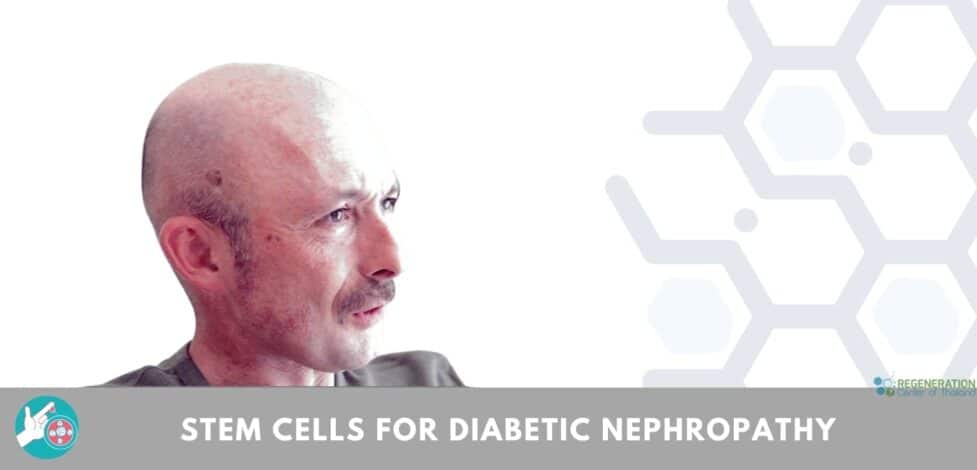 Stem Cells Treatment for Diabetic Nephropathy