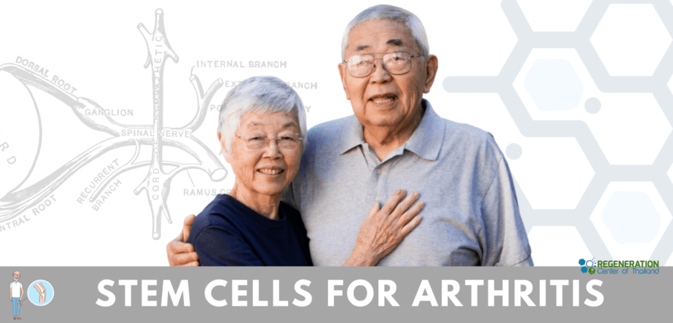 stem cell treatment Arthritis pain