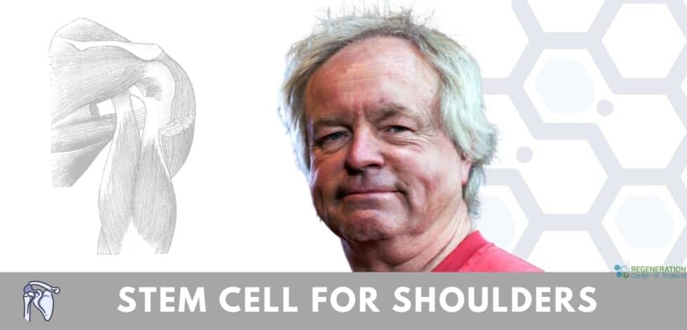 Stem cells treatment for shoulder injuries