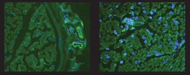 sciatic nerve infiltrated with green fluorescent T cells
