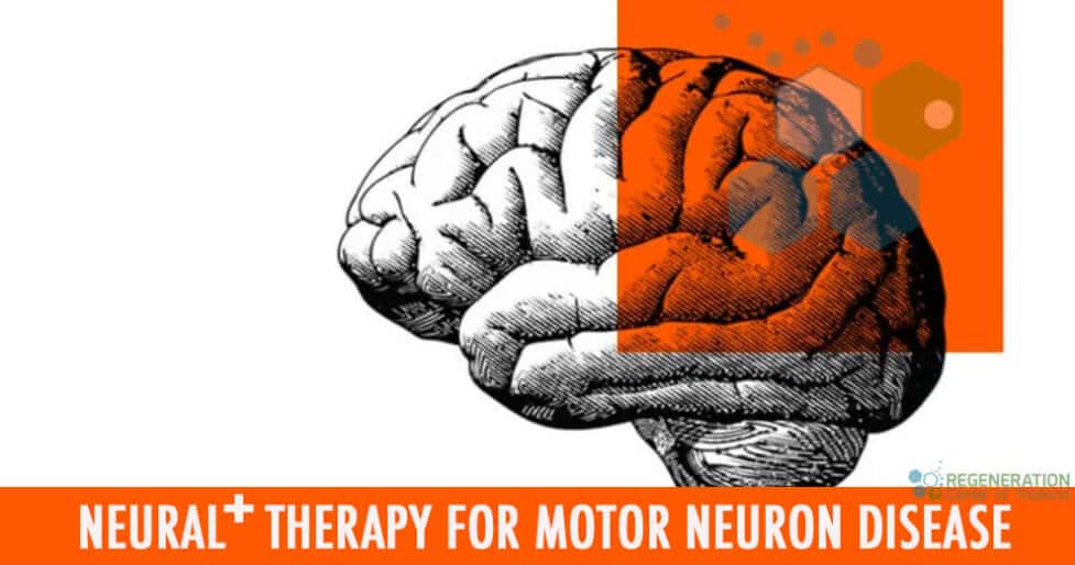 neural-stemcells-motor-neuron-disease