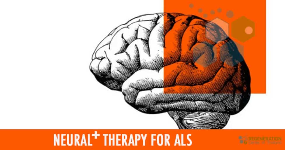 stemcell-treatment-als-2021-neuro