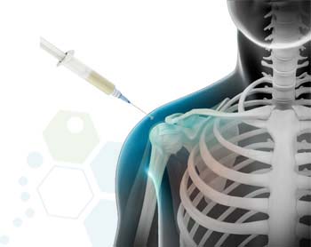 shoulder-stem-cell-injections